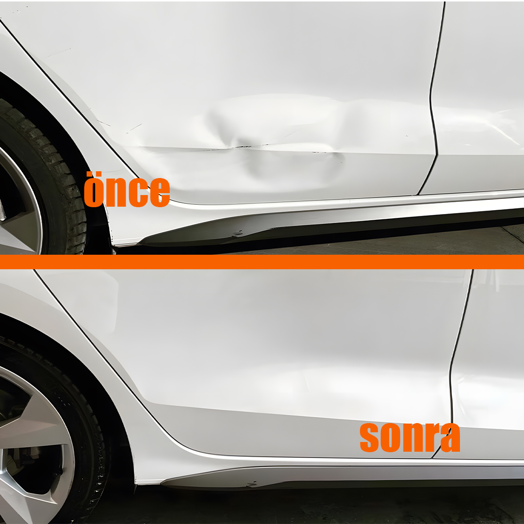 boyasızgöçükdüzeltme